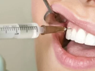 Anesthesia-dentalcrystal-pyx0hj5cizxouvk7czda8v8li0d31p2p5qyy91g7nc